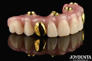 Quality 50ml Dentwre From United States Your Ultimate Solution Ti-Bar Acrylic Teeth Finish For Dental Treatment wholesale