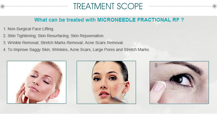 Fractional RF and Microneedle RF beauty Machine/fractional micro needle machine