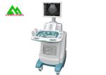 Full Digital Diagnostic Medical Ultrasound Equipment Trolley Ultrasound Scanner