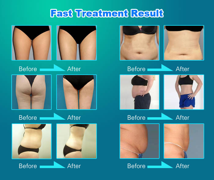 6MHZ Cavitation RF Vacuum Slimming Machine Portable For Anti Aging / Face Lifting