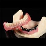 CAM Milled Titanium Bar Dental Implant Hybrid Prosthesis Dentures