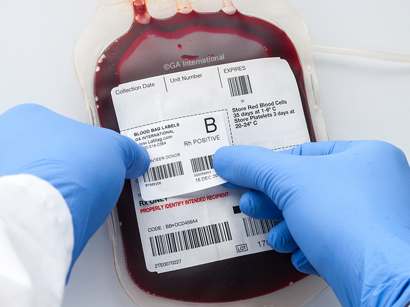 Rectangle UV Printing Blood Bag Sticker For Hospitals
