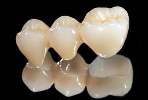 Quality All Ceramic Zirconia Dental Crown wholesale