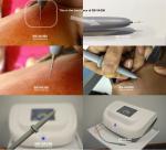 Portable 30MHZ High Frequency Vascular Removal Machine For Sun Spots Treatment