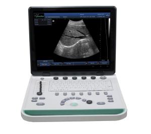 Quality PC based 3D Ultrasound Machine SS-9 Laptop Ultrasound scanner wholesale