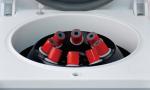 4000r/Min Plastic Housing Clinical Benchtop Centrifuge Small 120ml Metal