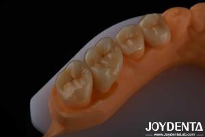 Quality High Aesthetics Full Contour Zirconia For Crowns Bridges Implants Dental Restorations wholesale