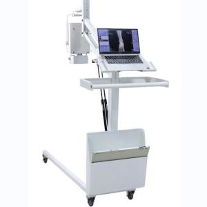 Quality High Frequency Mobile Digital Radiography Machine Digital X Ray Equipment wholesale