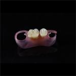 Comfortable Partial Valplast Flexible Dentures Nylon Material