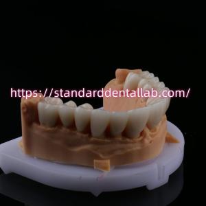 Quality FDA High Esthetics Dental Zirconia Bridge With Layered Porcelain zirconia dental crown China Dental Lab wholesale