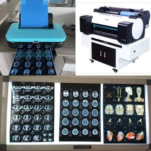 Quality 210um Inkjet Medical X Ray Film 3D CT MRI Image Output 8x10 14X17 Inch Blue Base wholesale
