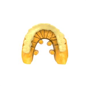 Quality Flexible Clear Permanent Crown Resin for Dental Restorations wholesale