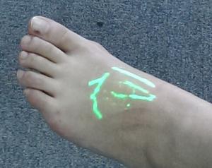 Quality Vascular Transilluminator Vein Finder Infrared Vein Locator Device To Find Varicose Veins wholesale