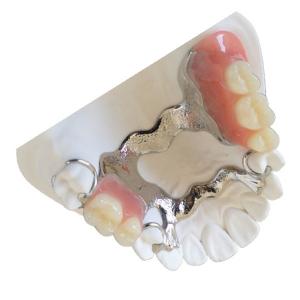 Quality Dental Lab PFM Dental Crown FDA Porcelain Fused To Metal Crown wholesale
