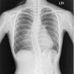 Quality KND-A / F Medical X Ray Films wholesale