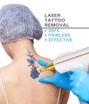 Skin Whitening Nail Fungus Laser Treatment Machine 1064nm 532nm 1320nm
