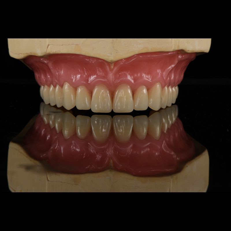 Removable Smile Full Acrylic Complete Denture Customizable