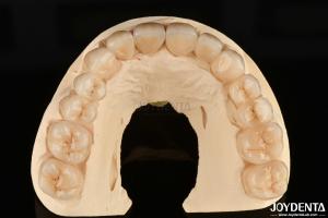 Quality High Resistance To Corrosion Full Zirconia The Preferred Material for White Dental Restorations wholesale