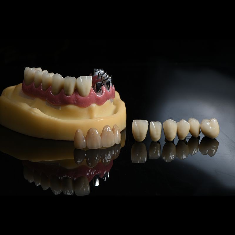 Dentists Cad Cam PFM Crown Ceramic Material Metal Foundation