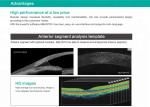 Spectral Domain OCT Optical Coherence Tomography for ophthalmology department