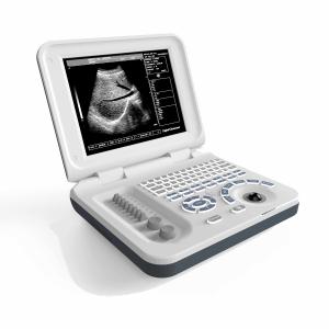 Quality Multipurpose Equine Vet Portable Ultrasound Machine DRF RDA wholesale