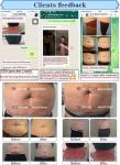 Coolsculption cryolipolysi fat freezing body slimming cryolipolysis weight loss