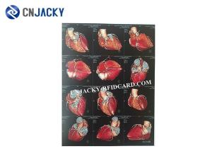 Quality 0.15mm Medical Radiation Printing Film wholesale