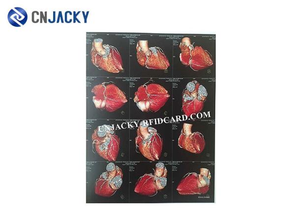 0.15mm Medical Radiation Printing Film
