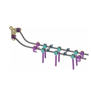 Quality Vertebar Rods System Posterior Cervical Screws Insert Spine Fixation Device wholesale