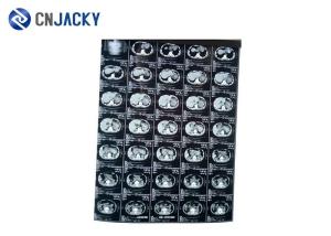Quality 195 Micron Dental X Ray Film wholesale