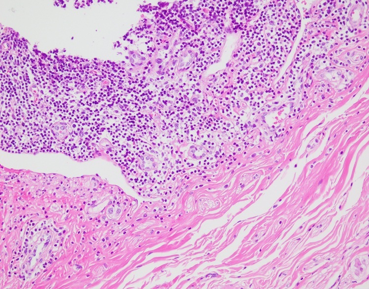 Laboratory Hematoxylin Stain (Gill) 1000ml For Healthcare Facility