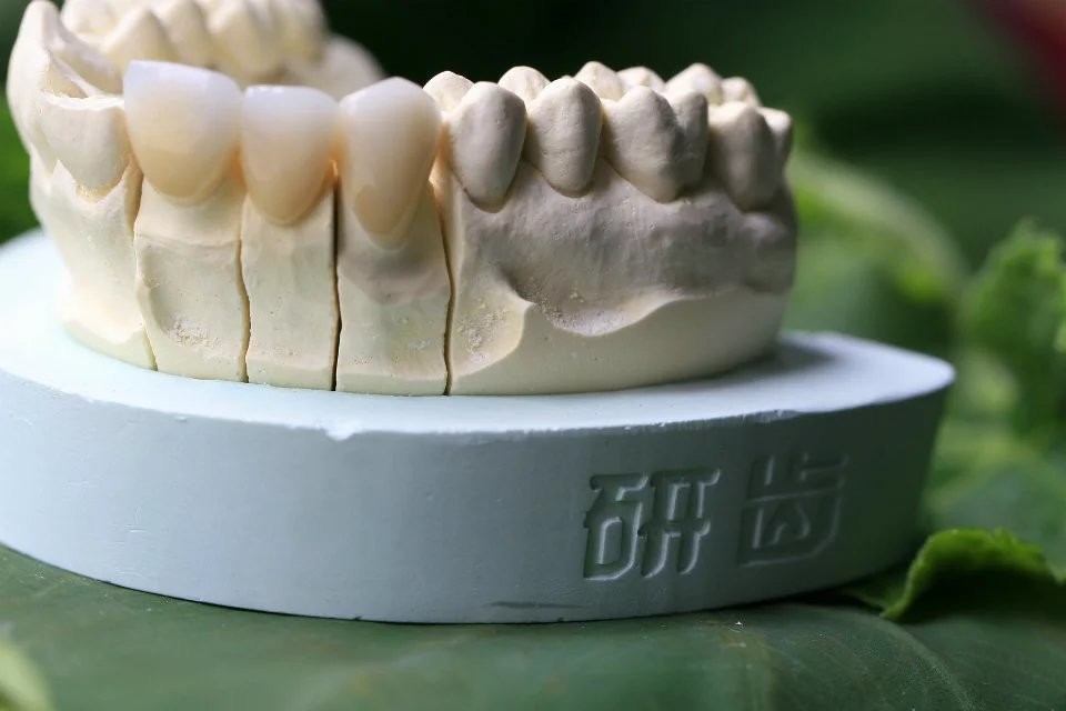 Fixed Prosthetics Permanent Solution EMAX Dental Crown