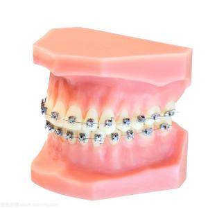 Quality Dental Braces Fixed Orthodontic Appliances Upgrade Soft Wire Brackets wholesale