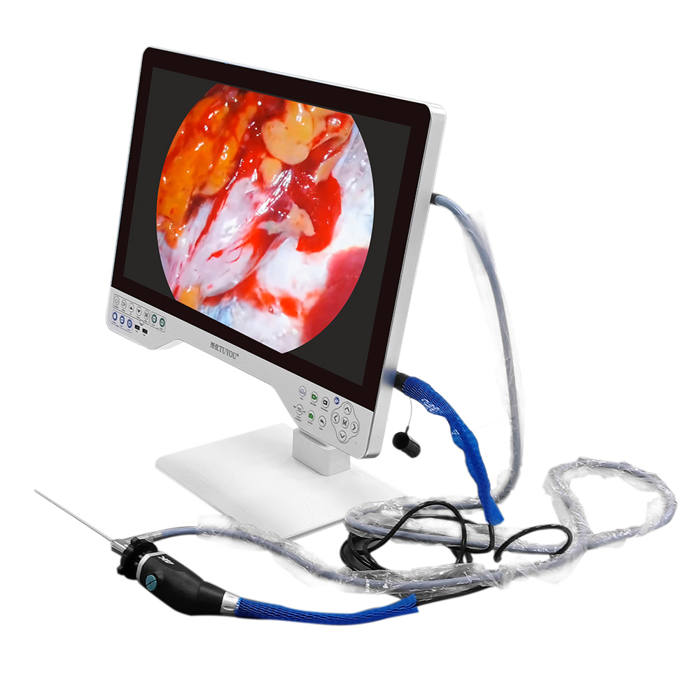 Precision 32" 4K Medical ENT Endoscope Camera USB Laparoscopic System Complete With Light Source And Monitor
