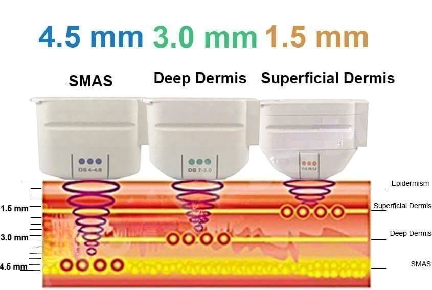 2024 Newest HIFU 12D Anti Aging High Intensity Slimming Machine Face Lifting Wrinkle Removal