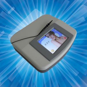 Quality 30MHz Spider Vein Removal Machine / Laser Vein Removal / Vascular Removal wholesale