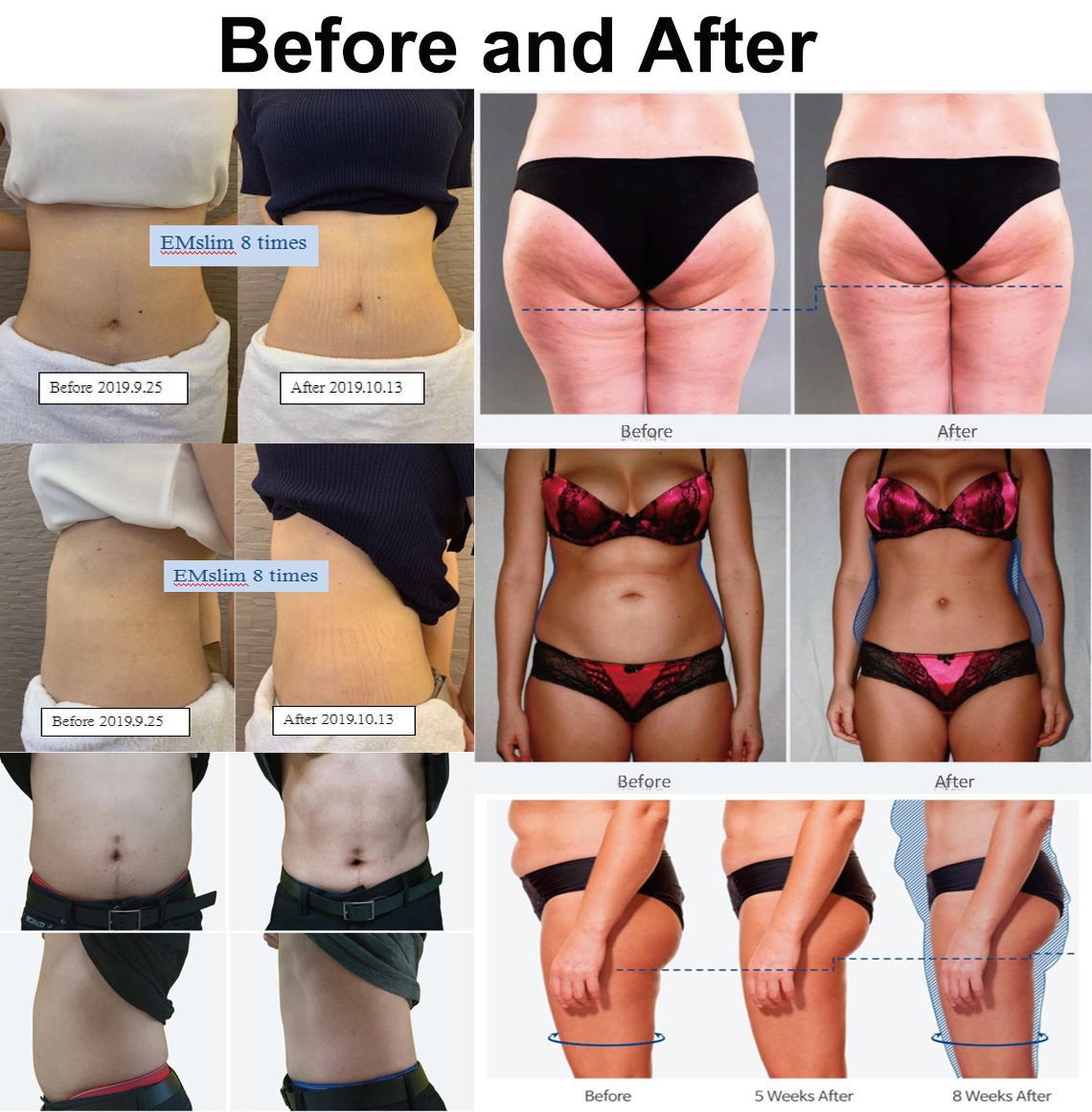 Beauty Vacuum RF Slimming Machine , Standing Cellulite Vacuum Roller Machine