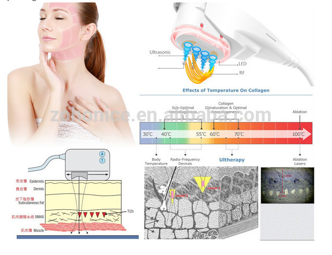 Home High Intensity Focused sound Machine and Female Face Lifting Beauty Device