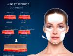 Vertical Magnetic Facial Ems rf Skin Rejuvenation Lifting Skin Tightening