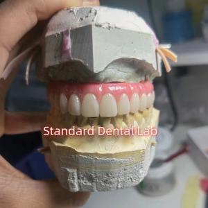 Quality Screw Retained Titanium PMMA Dental Bridge Temporary Crown wholesale