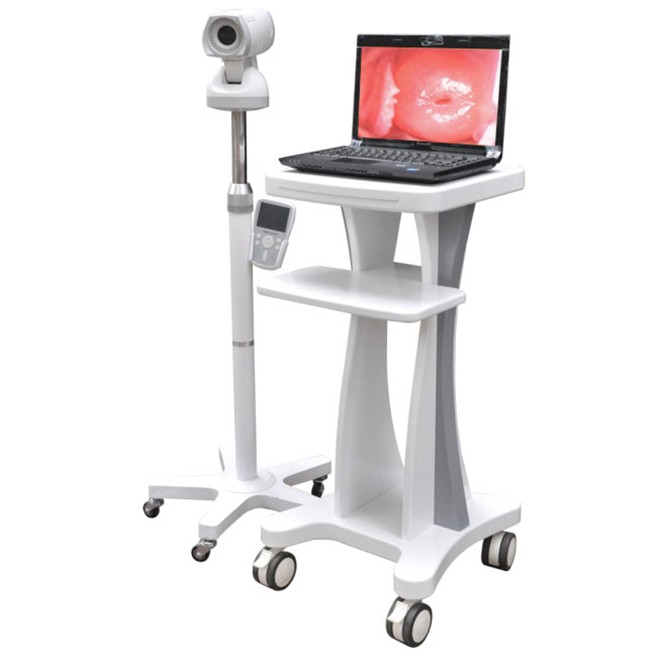 Professional Video Colposcope Endoscope Gynaecology Colposcope CE03