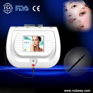 Quality Laser Wart Spider Veins Removal On Legs / Face , Red Vein Removal wholesale