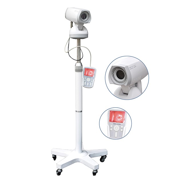 Professional Video Colposcope Endoscope Gynaecology Colposcope CE03