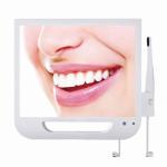 17 Inch LED Screen Dental Endoscope Factory High Pixel Intra Oral Camera With