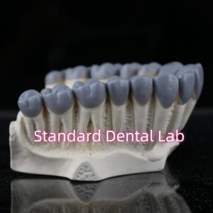 Quality SDL Dental Lab Digital Diagnostic Wax Ups Crown Bridge wholesale