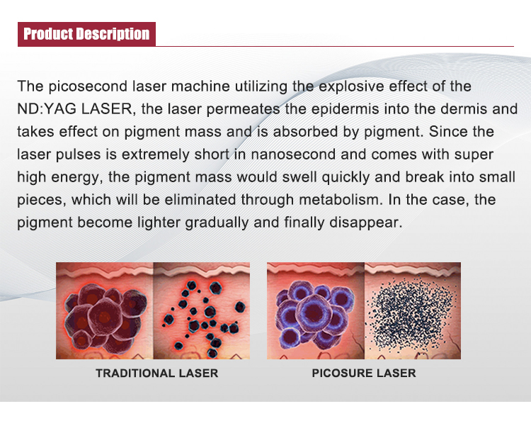 DPL q switched nd yag laser picosecond tattoo removal pico skin whitening machine picosecond laser opt machine