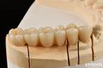 Natural Looking Multilayer Full Zirconia For Dental Restorations Ultra