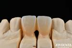 1350-1450°C Sintering Temperature Layered Zirconia For Superior Biocompatibility