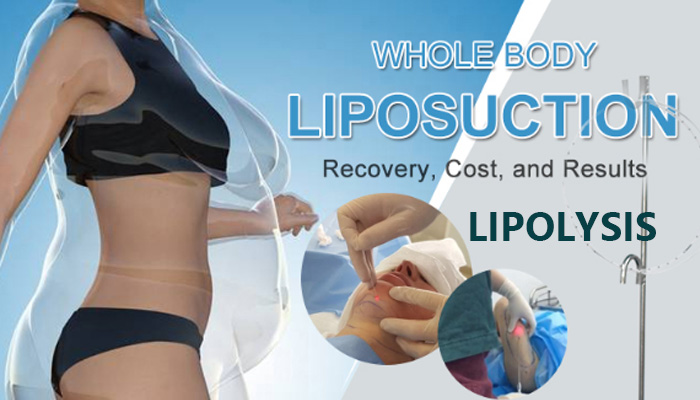 2 In 1 Non Surgical Liposuction Machine 980nm Lipolysis Laser Machine