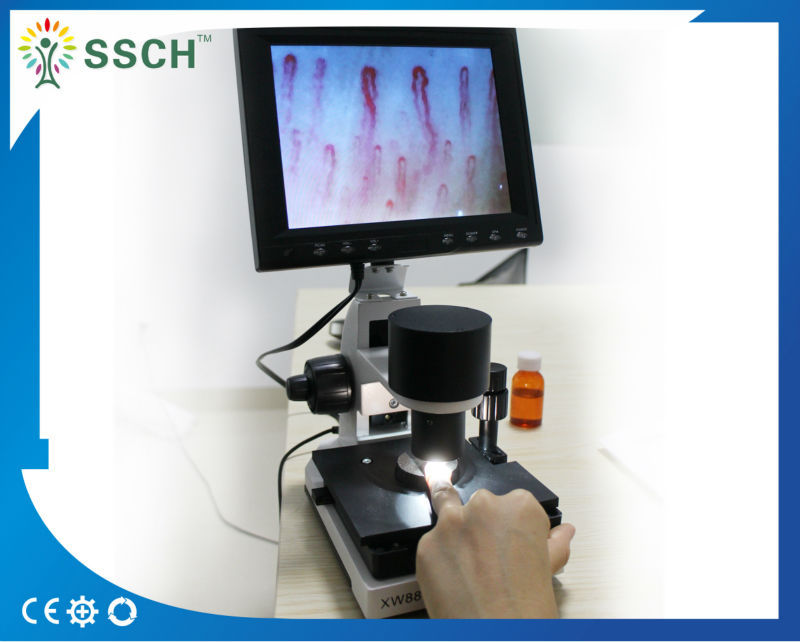 7 Inch Black LCD Capillary Nail Microcirculation LED Cold Light